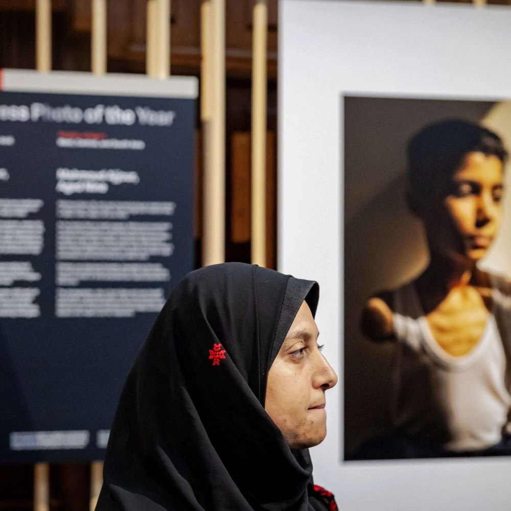 "Como vou abraçar?" Foto do ano retrata menino que perdeu os braços em Gaza